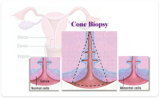 Shave Skin Biopsy - WebMD