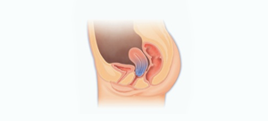 Description: uterine.jpg